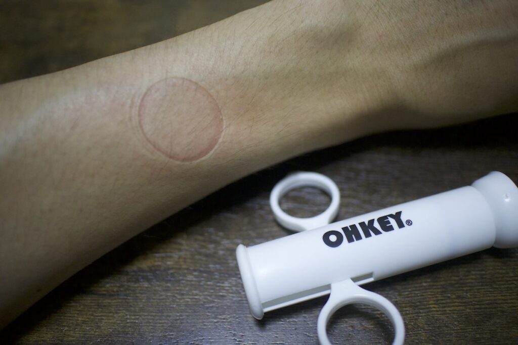 登山で実際に使って感じたOHKEY救急キットの3つのメリット